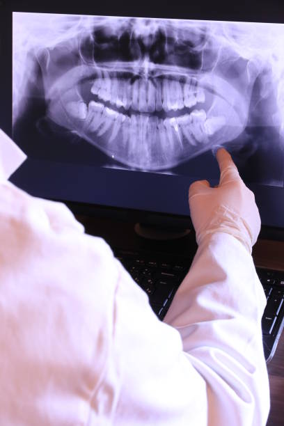 Best Broken or Cracked Tooth Emergency Dentist in Yankton, SD