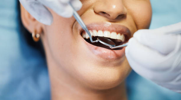 Best Emergency Dental Services for Seniors in Yankton, SD
