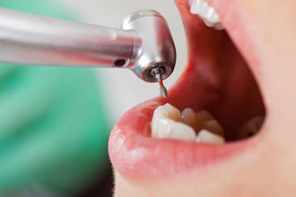 Best Pediatric Emergency Dentist in Yankton, SD